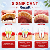 SP-4 Probiotic Brightening and cleaning toothpaste ( 120gm )