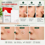 DermaSmooth Skin Tag Remover Patch