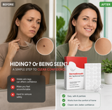 DermaSmooth Skin Tag Remover Patch